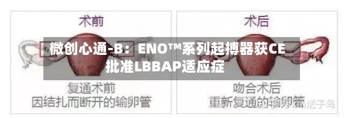 微创心通-B：ENO™系列起搏器获CE批准LBBAP适应症